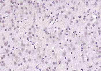 RANBP9 Rabbit Polyclonal Antibody