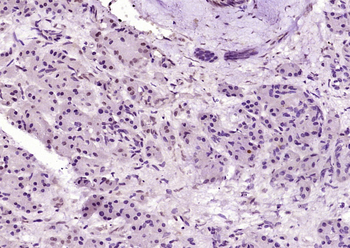 KIFC1 Rabbit Polyclonal Antibody