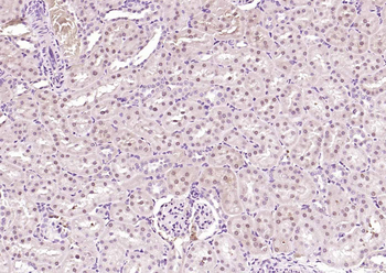 KIFC1 Rabbit Polyclonal Antibody