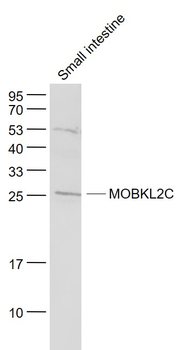 MOBKL2C Rabbit Polyclonal Antibody