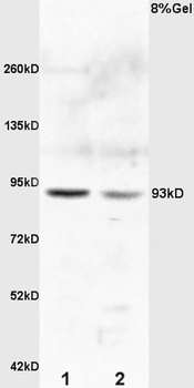 E2F8 Rabbit Polyclonal Antibody
