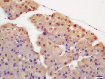 HnRNP F Rabbit Polyclonal Antibody