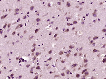 Alpha Adaptin Rabbit Polyclonal Antibody