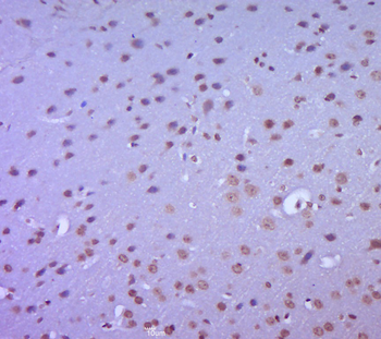 TPX2 Rabbit Polyclonal Antibody