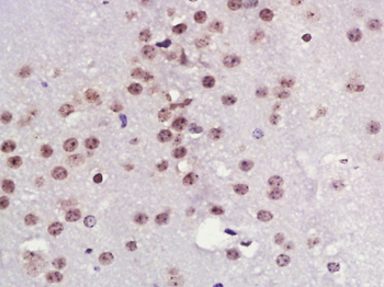 TPX2 Rabbit Polyclonal Antibody