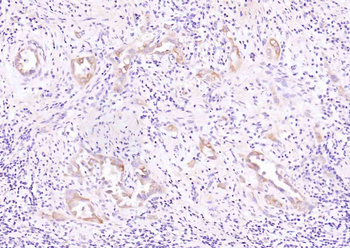 RIPK1 Rabbit Polyclonal Antibody