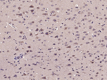 RIPK1 Rabbit Polyclonal Antibody