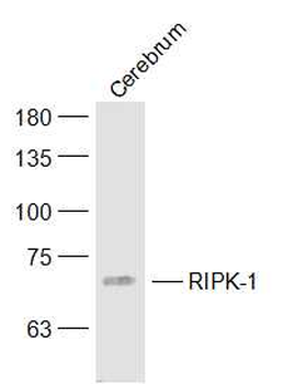 RIPK1 Rabbit Polyclonal Antibody