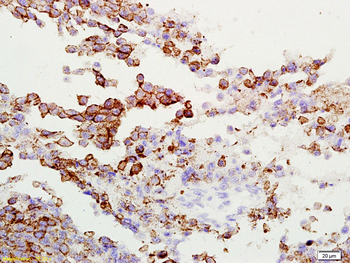 Gamma-Adaptin Rabbit Polyclonal Antibody