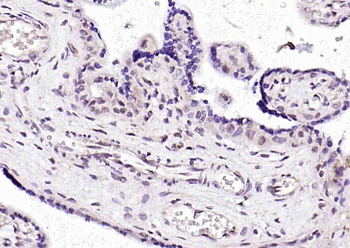 MBD1 Rabbit Polyclonal Antibody