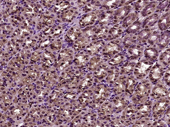 MBD1 Rabbit Polyclonal Antibody