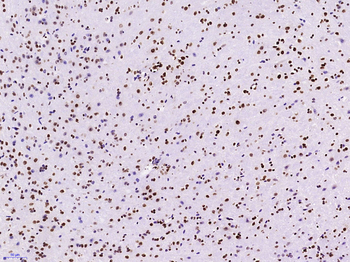 KLHL7 Rabbit Polyclonal Antibody
