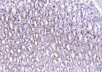 SIRT3 Rabbit Polyclonal Antibody