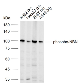 Phospho-NBN (Ser343) Rabbit Polyclonal Antibody