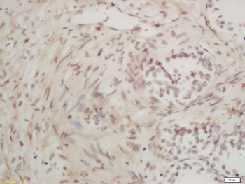 CAMK1D Rabbit Polyclonal Antibody