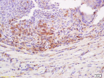 Desmoglein 3 Rabbit Polyclonal Antibody