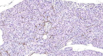 APCDD1 Rabbit Polyclonal Antibody