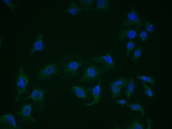 CGKI Rabbit Polyclonal Antibody
