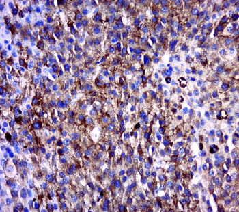 MAGEB6 Rabbit Polyclonal Antibody