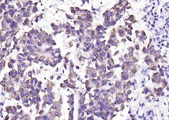 ADM2 Rabbit Polyclonal Antibody
