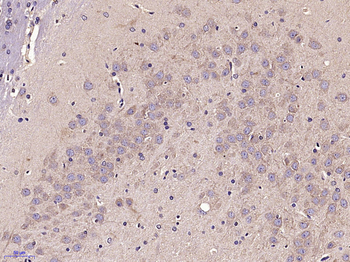 ADM2 Rabbit Polyclonal Antibody