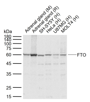 FTO Rabbit Polyclonal Antibody