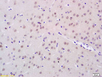 FTO Rabbit Polyclonal Antibody