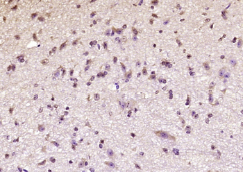 CLOCK Rabbit Polyclonal Antibody