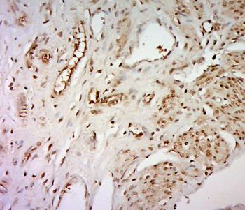 WDR61 Rabbit Polyclonal Antibody