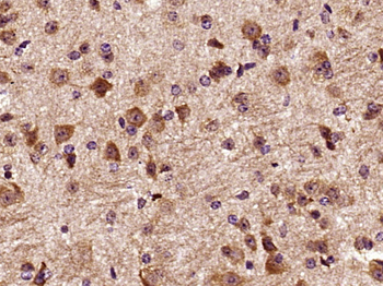 DCTN3 Rabbit Polyclonal Antibody