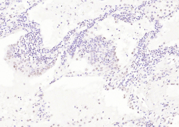 APPL1 Rabbit Polyclonal Antibody