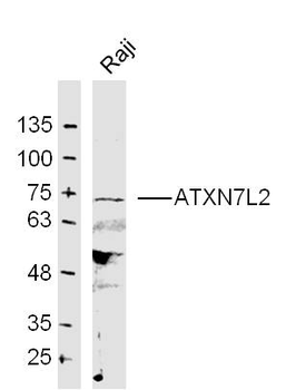 ATXN7L2 Rabbit Polyclonal Antibody