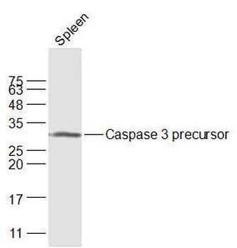 Apoptosis Research Antibody Assembly kit(bcl-2, bax, Caspase-3, Caspase-9, Cytochrome C)