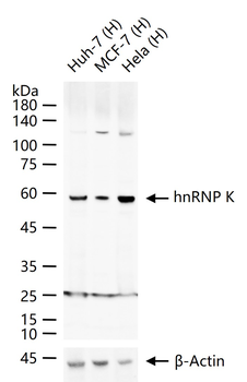 HnRNP K Rabbit Polyclonal Antibody
