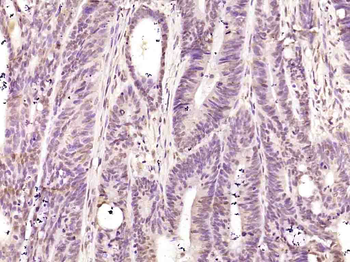 HnRNP K Rabbit Polyclonal Antibody