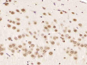 HnRNP K Rabbit Polyclonal Antibody