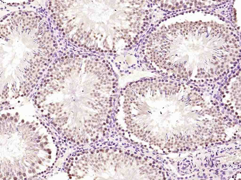 HnRNP K Rabbit Polyclonal Antibody