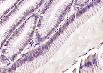 ELAC2/HPC2 Rabbit Polyclonal Antibody
