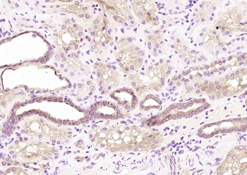 TACC2 Rabbit Polyclonal Antibody