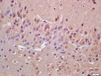 VAV3 Rabbit Polyclonal Antibody
