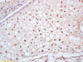 CDC2L1 Rabbit Polyclonal Antibody