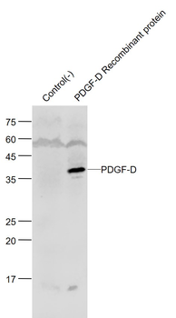 PDGF-D/SCDGFB Rabbit Polyclonal Antibody