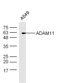 ADAM11 Rabbit Polyclonal Antibody