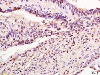 AIM2 Rabbit Polyclonal Antibody