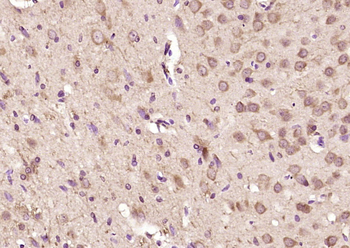 FBXO31 Rabbit Polyclonal Antibody