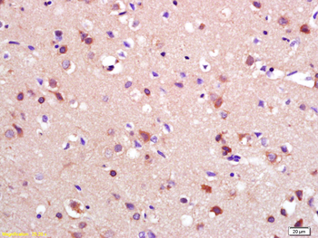RASGEF1A Rabbit Polyclonal Antibody