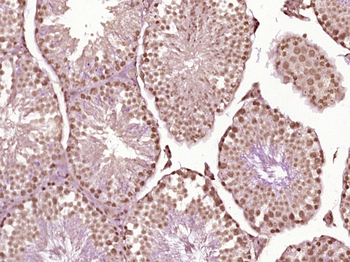 IMPDH1 Rabbit Polyclonal Antibody