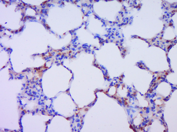 IMPDH1 Rabbit Polyclonal Antibody