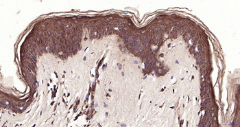 PTK6 Rabbit Polyclonal Antibody