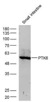 PTK6 Rabbit Polyclonal Antibody